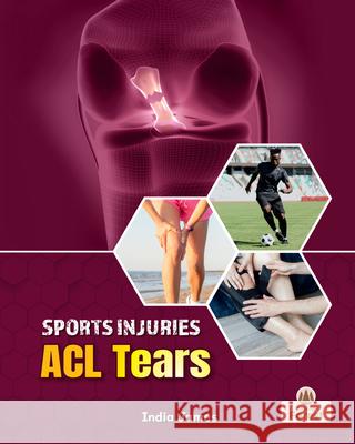ACL Tears India James 9781039880795