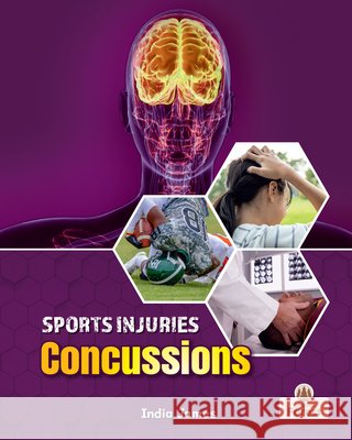 Concussions India James 9781039880801
