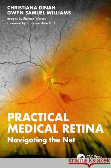Practical Medical Retina: Navigating the Net Gwyn Samuel (Singleton Hospital, Eye Department, Sketty Lane, Sketty, Swansea, SA2 8QA, Wales, UK) Williams 9781041044208 CRC Press