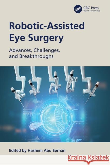 Robotic-Assisted Eye Surgery: Advances, Challenges, and Breakthroughs Hashem Ab 9781041231981