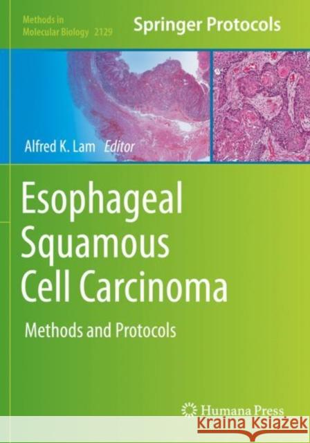 Esophageal Squamous Cell Carcinoma: Methods and Protocols Alfred K. Lam 9781071603796 Humana