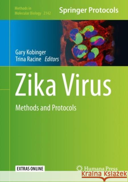 Zika Virus: Methods and Protocols Kobinger, Gary 9781071605806 Humana