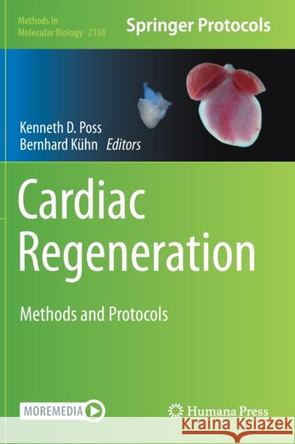 Cardiac Regeneration: Methods and Protocols Poss, Kenneth D. 9781071606674 Humana