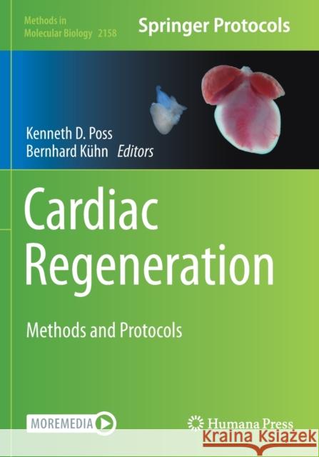 Cardiac Regeneration: Methods and Protocols Poss, Kenneth D. 9781071606704 Springer US