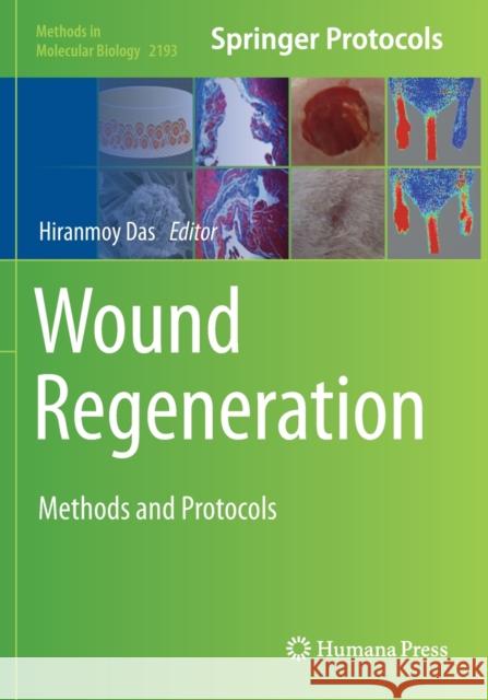 Wound Regeneration: Methods and Protocols Hiranmoy Das 9781071608470 Humana