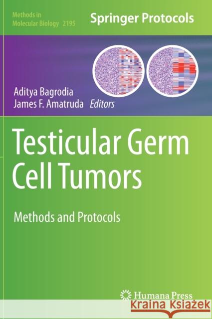 Testicular Germ Cell Tumors: Methods and Protocols Bagrodia, Aditya 9781071608593