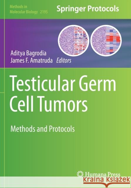 Testicular Germ Cell Tumors: Methods and Protocols Aditya Bagrodia James F. Amatruda 9781071608623 Humana