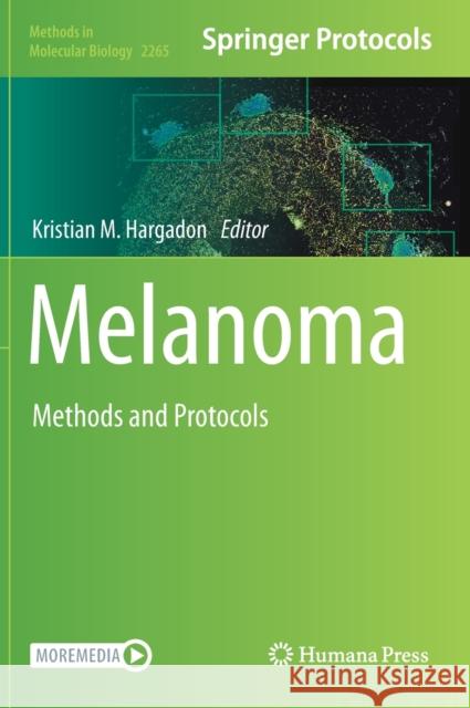 Melanoma: Methods and Protocols Kristian M. Hargadon 9781071612040 Humana