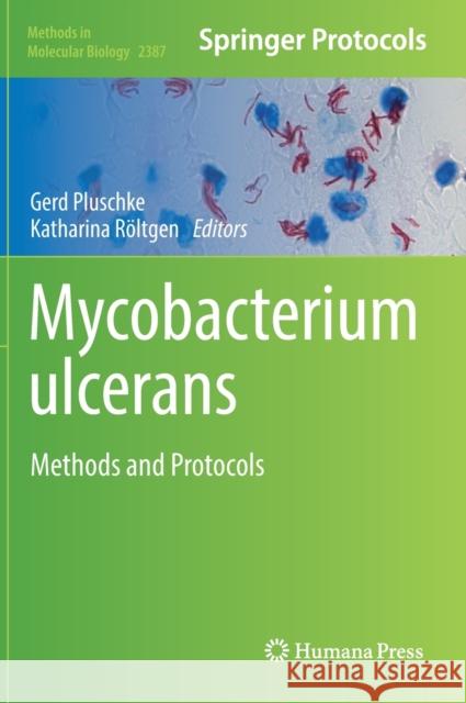 Mycobacterium Ulcerans: Methods and Protocols Gerd Pluschke Katharina Roeltgen 9781071617786 Humana