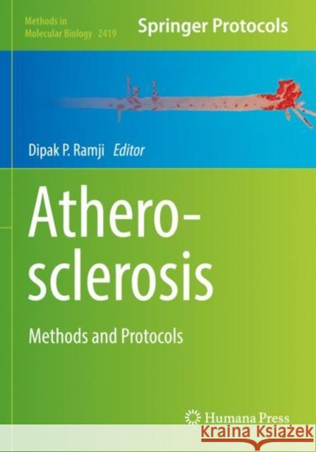 Atherosclerosis: Methods and Protocols Dipak Ramji 9781071619261 Humana