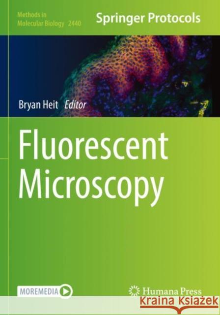 Fluorescent Microscopy Bryan Heit 9781071620533 Humana