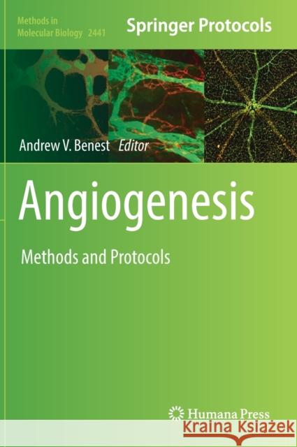 Angiogenesis  9781071620588 Springer US