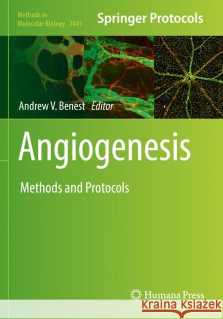 Angiogenesis: Methods and Protocols Andrew V. Benest 9781071620618 Humana