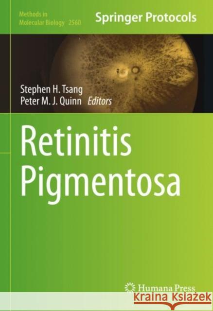 Retinitis Pigmentosa Stephen H. Tsang Peter M. J. Quinn 9781071626504