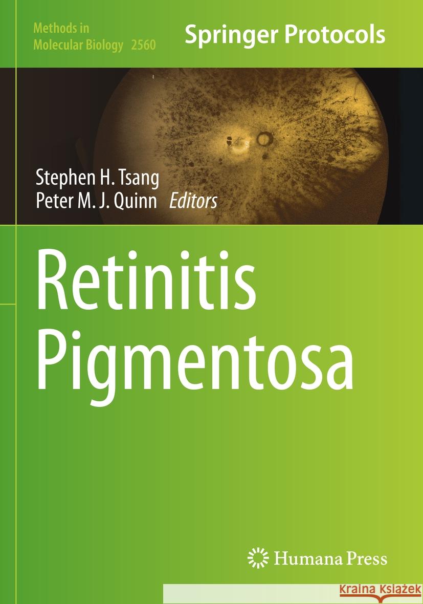 Retinitis Pigmentosa Stephen H. Tsang Peter M. J. Quinn 9781071626535