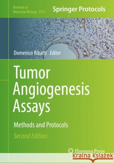Tumor Angiogenesis Assays: Methods and Protocols Ribatti, Domenico 9781071627020