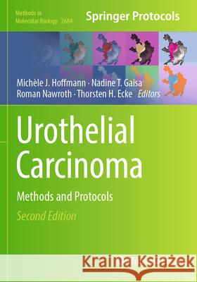 Urothelial Carcinoma: Methods and Protocols Mich?le J. Hoffmann Nadine T. Gaisa Roman Nawroth 9781071632932