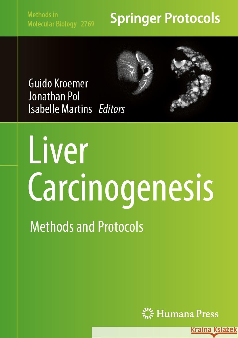 Liver Carcinogenesis: Methods and Protocols Guido Kroemer Jonathan Pol Isabelle Martins 9781071636930 Humana