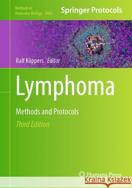 Lymphoma: Methods and Protocols Ralf K?ppers 9781071641873 Humana