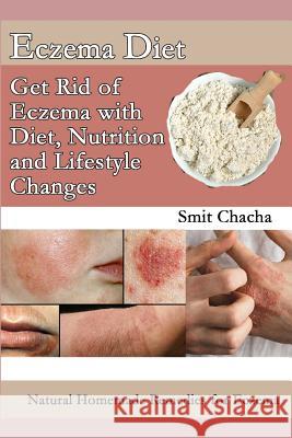 Eczema Diet - Get Rid of Eczema with Diet, Nutrition and Lifestyle Changes: Natural Homemade Remedies for Eczema Smit Chacha 9781072818793