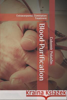 Blood Purification: Extracorporeal Elimination Treatment Ľubomir Polasčin 9781090110756 Independently Published