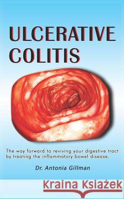 Ulceratlve Colltls: A Way Forward to Reviving Your Digestive Tract by Treating the Inflammatory Bowel Disease Gillman, Antonia 9781090636324 Independently Published