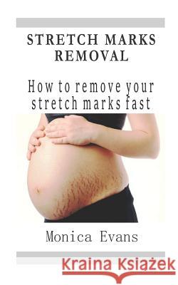 Stretch Marks Removal: How to remove your stretch marks fast Monica Evans 9781097469215 Independently Published