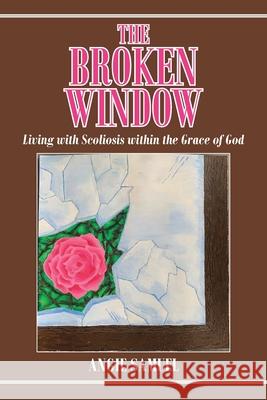 The Broken Window: Living with Scoliosis within the Grace of God Angie Samuel 9781098038816 Christian Faith