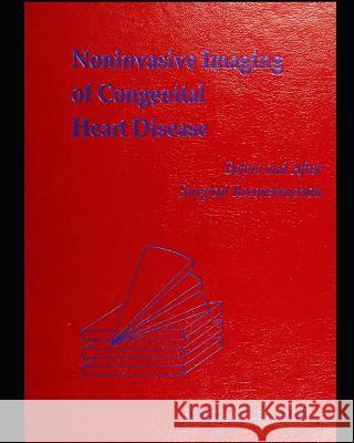 Noninvasive imaging of congenital heart disease: before and after surgical reconstruction Alvin Chin 9781099119088