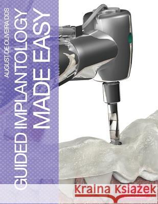 Guided Implantology Made Easy August de Oliveira 9781105705687 Lulu.com