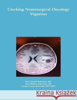 Cracking Neurosurgical Oncology Vignettes Paul Edward Kaloostia Sean William Kaloostia Carolyn Louisa Kaloostia 9781105988844