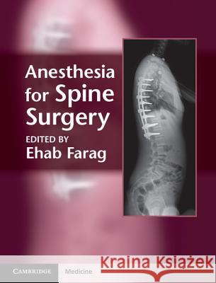 Anesthesia for Spine Surgery Ehab Farag 9781107005310