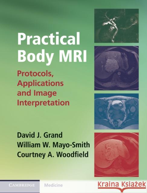 Practical Body MRI: Protocols, Applications and Image Interpretation Grand, David J. 9781107014046 Cambridge University Press