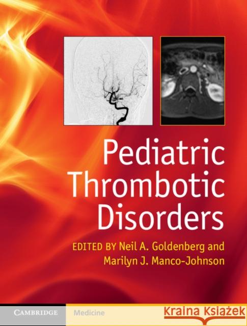 Pediatric Thrombotic Disorders Marilyn Manco-Johnson Neil Goldenberg 9781107014541 Cambridge University Press