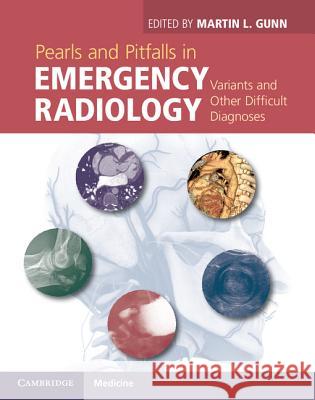 Pearls and Pitfalls in Emergency Radiology: Variants and Other Difficult Diagnoses Gunn, Martin L. 9781107021914 CAMBRIDGE UNIVERSITY PRESS