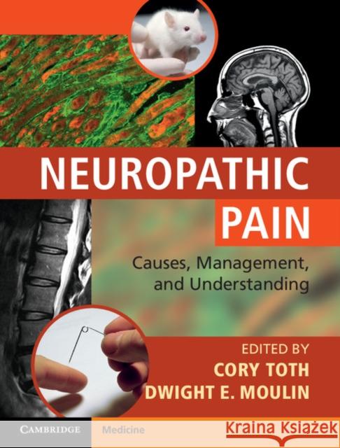 Neuropathic Pain: Causes, Management and Understanding Toth, Cory 9781107023710