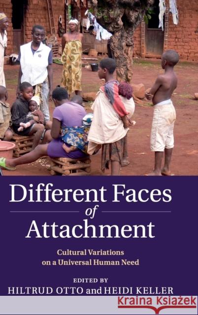 Different Faces of Attachment: Cultural Variations on a Universal Human Need Otto, Hiltrud 9781107027749
