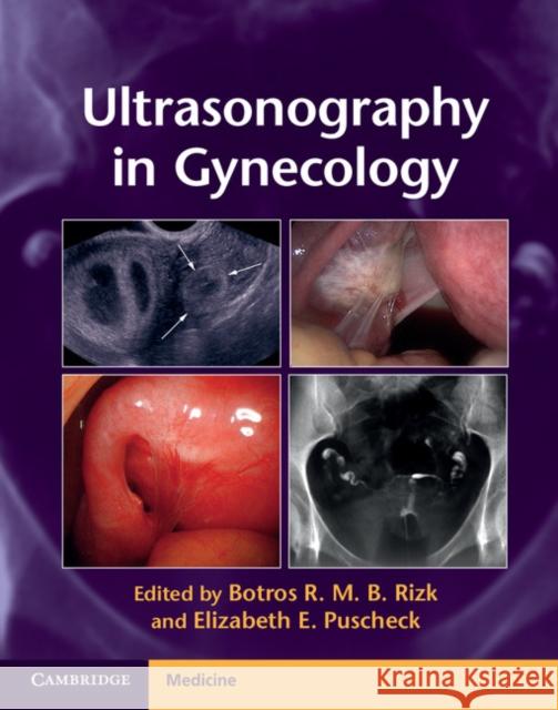 Ultrasonography in Gynecology Botros R M B Rizk 9781107029743