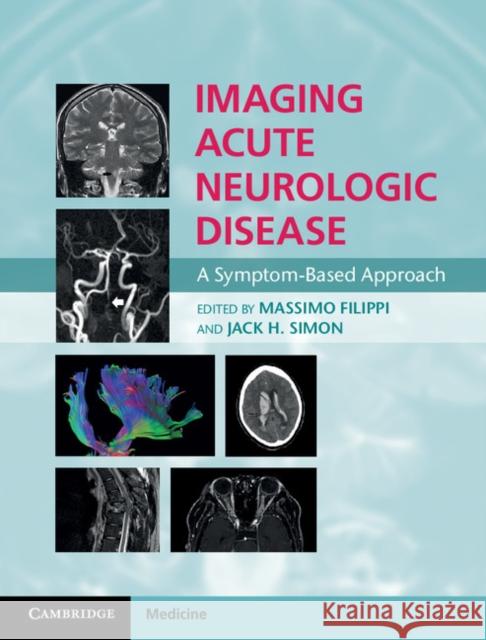 Imaging Acute Neurologic Disease: A Symptom-Based Approach Filippi, Massimo 9781107035942 Cambridge University Press