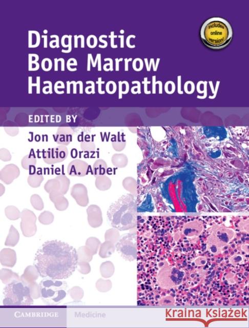 Diagnostic Bone Marrow Haematopathology Book with Online content Daniel A. (University of Chicago) Arber 9781107040137