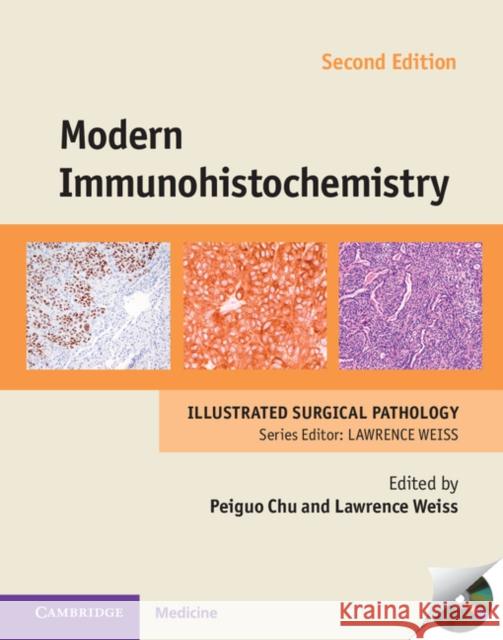 Modern Immunohistochemistry with DVD-ROM Peiguo Chu & Lawrence Weiss 9781107040151 CAMBRIDGE UNIVERSITY PRESS