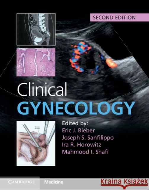 Clinical Gynecology Eric J Bieber 9781107040397