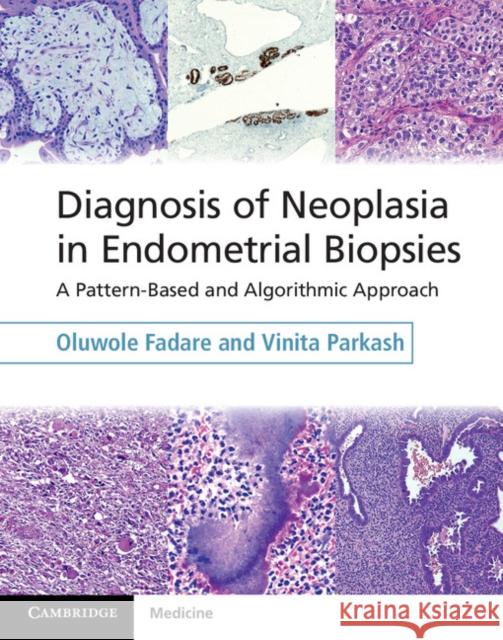 Diagnosis of Neoplasia in Endometrial Biopsies Book and Online Bundle: A Pattern-Based and Algorithmic Approach [With eBook] Fadare, Oluwole 9781107040434 Cambridge University Press