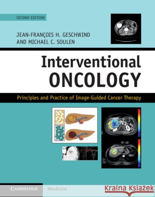 Interventional Oncology: Principles and Practice of Image-Guided Cancer Therapy Jean-Francois Geschwind Michael Soulen 9781107043473