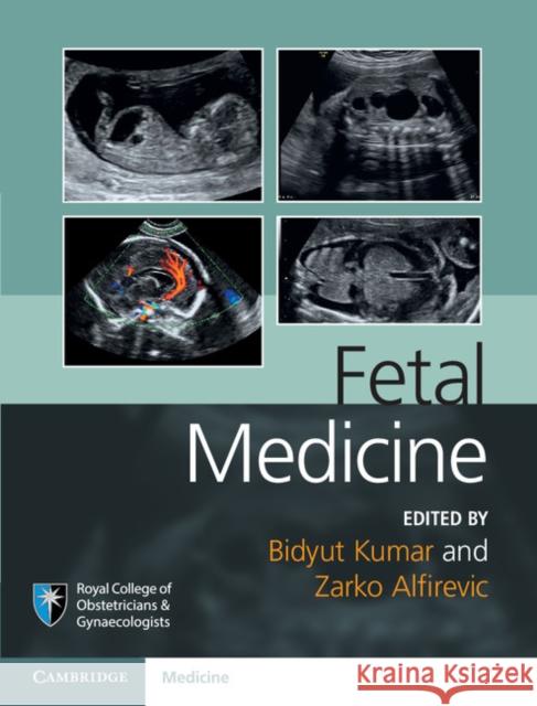 Fetal Medicine Bid Kumar 9781107064348 CAMBRIDGE UNIVERSITY PRESS