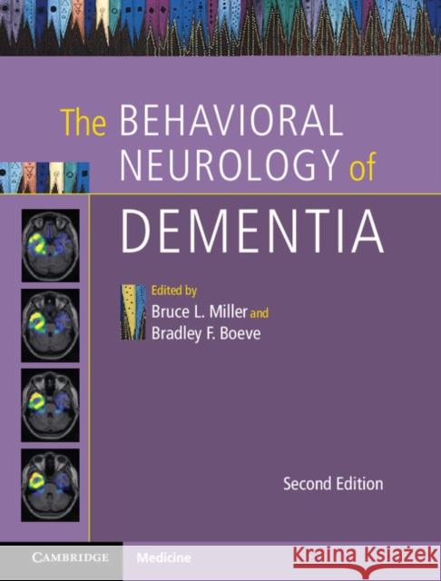 The Behavioral Neurology of Dementia Bruce Miller Bradley Boeve 9781107077201