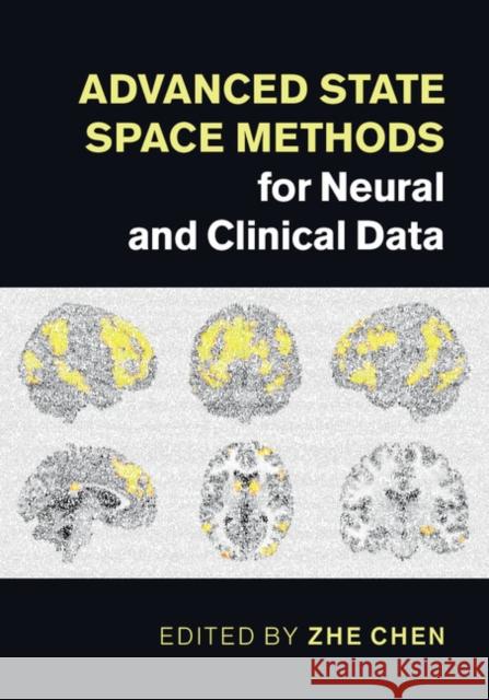 Advanced State Space Methods for Neural and Clinical Data Zhe Chen 9781107079199 Cambridge University Press