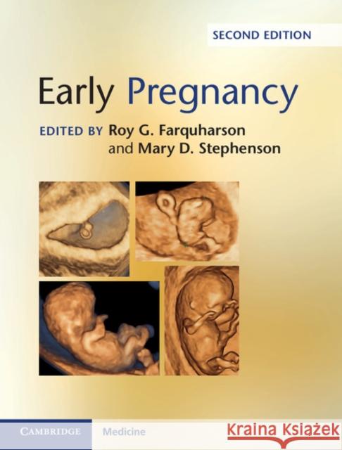 Early Pregnancy Roy Farquharson Mary Stephenson  9781107082014 Cambridge University Press