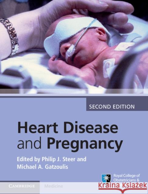 Heart Disease and Pregnancy Philip J Steer 9781107095946