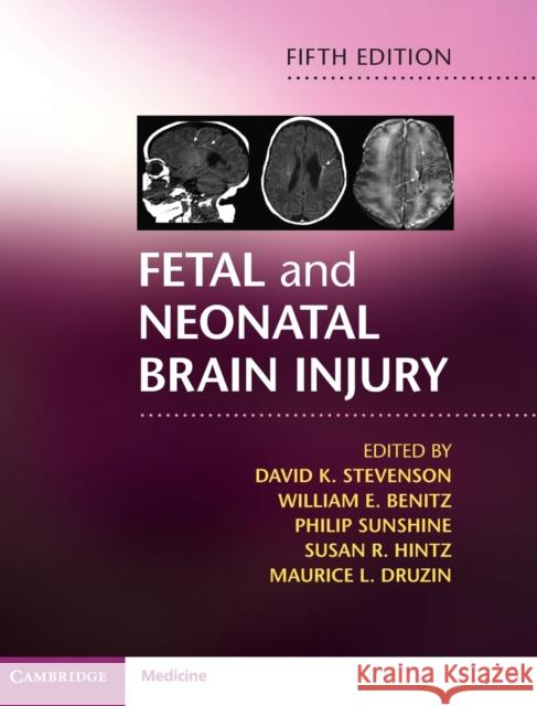 Fetal and Neonatal Brain Injury David K. Stevenson William E. Benitz Philip Sunshine 9781107110809